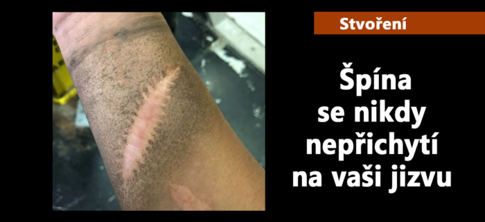 Stvoření: 20. Špína se nikdy nepřichytí na vaši jizvu